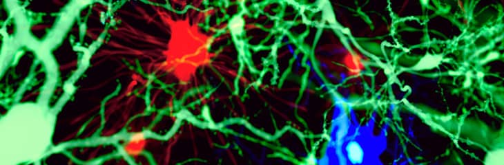Auch Neurone des Zentralen Nervensystems brauchen Unterstützung. Hier zwei „Helferzellen“-Typen: Mikroglia-Zellen (blau) und Astrocyten (rot).